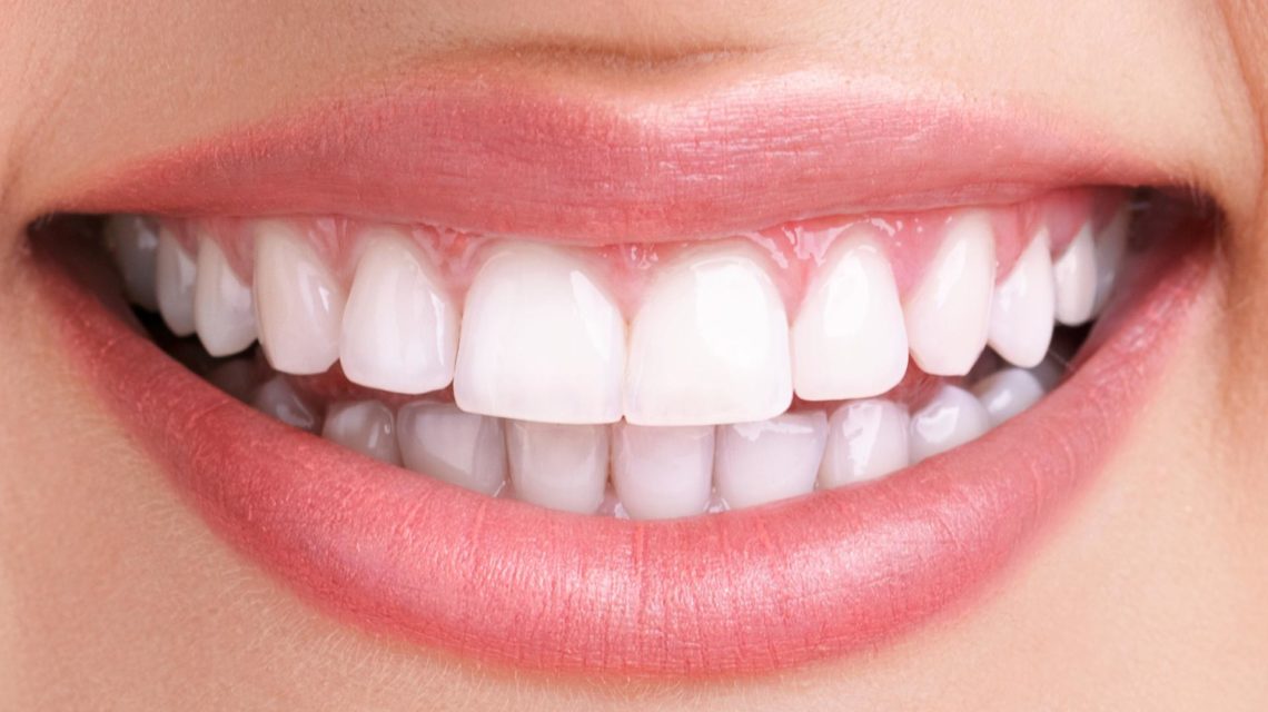 طرح لبخند دندان چیست؟ | کلینیک دکتر مهدی ابوالقاسمی
