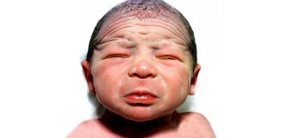 روانشناسی زشتی در کودکان: به من می‌گن میمون!