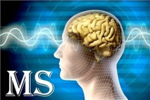 درمان ام اس با شیمی‌درمانی