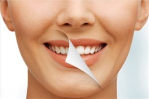 تا دید و بازدید عید دندان‌هایتان را برق بیندازید