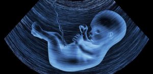 سونوگرافى در حاملگى چه زمان و چرا؟