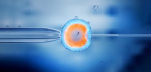 درمان ناباروری؛ICSI با IVF و IUI چه فرقی دارد؟