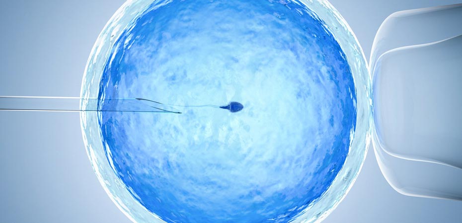 IVF باعث سرطان تخمدان می‌شود؟