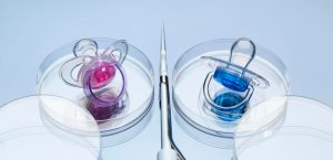 تعیین جنسیت با آی وی اف (IVF) ممکن است؟
