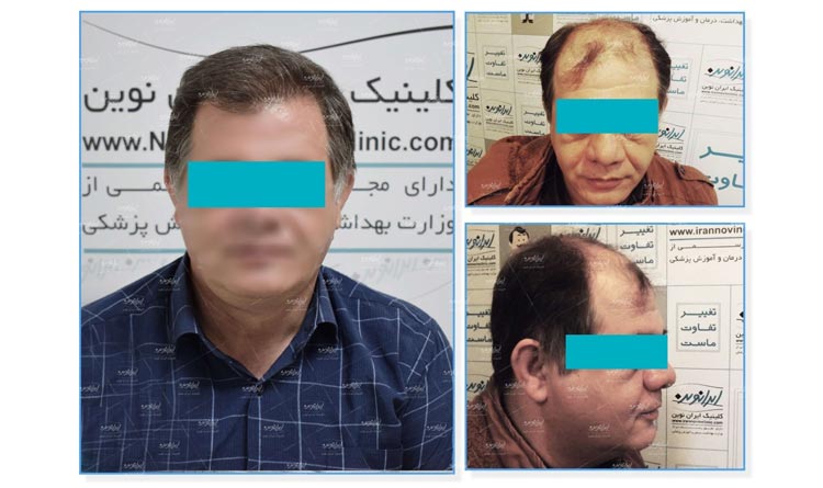 کلینیک مو