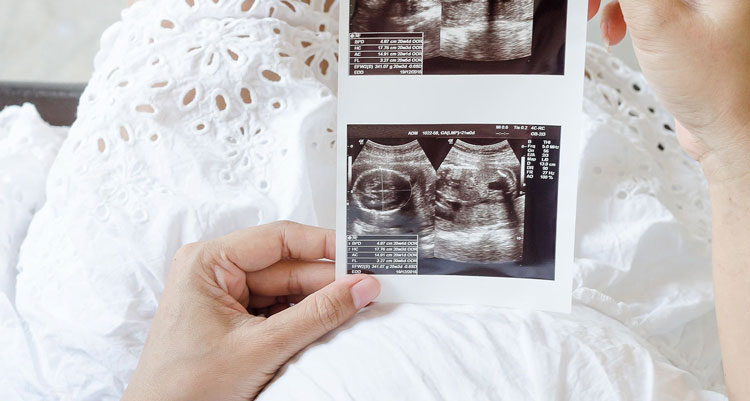 نتیجه سونوگرافی در بارداری