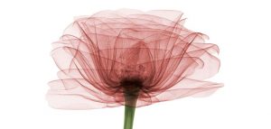 لابیاپلاستی با لیزر چگونه و به چه منظور انجام می شود؟