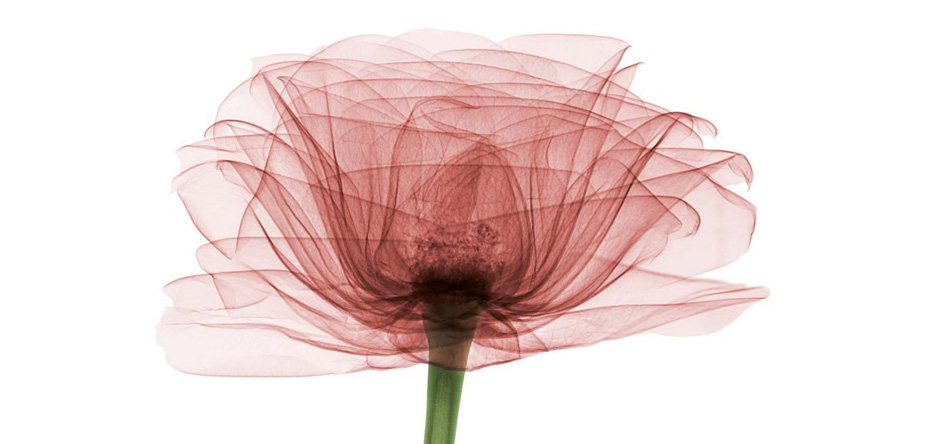 لابیاپلاستی با لیزر چگونه و به چه منظور انجام می شود؟